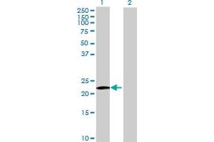 Western Blot analysis of MS4A8B expression in transfected 293T cell line by MS4A8B MaxPab polyclonal antibody.