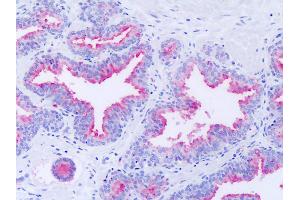 Anti-GPR63 antibody IHC of human prostate. (GPR63 antibody  (Extracellular Domain))