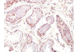 Formalin-fixed, paraffin-embedded human Testicular Carcinoma stained with MAGE-1 Monoclonal Antibody (MZ2E/838). (MAGEA1 antibody)