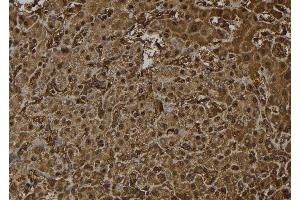 ABIN6272379 at 1/100 staining Human liver tissue by IHC-P. (OTUB2 antibody  (Internal Region))