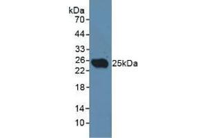 Western blot analysis of Rat Testis Tissue. (CLEC10A antibody  (AA 71-239))