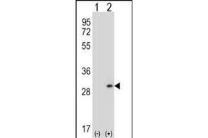 Western blot analysis of DPT (arrow) using rabbit polyclonal DPT Antibody (N-term) (ABIN656571 and ABIN2845833). (Dermatopontin antibody  (N-Term))