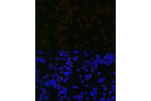 Immunofluorescence analysis of Raw264 7 cells using iNOS Rabbit mAb (ABIN1678965, ABIN3018084, ABIN3018085 and ABIN7101575) at dilution of 1:100 (40x lens). (NOS2 antibody)