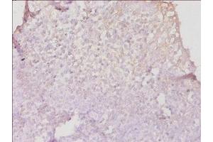 Immunohistochemistry of paraffin-embedded human tonsil tissue using ABIN7155585 at dilution of 1:50 (HLA-DPB1 antibody  (AA 30-225))