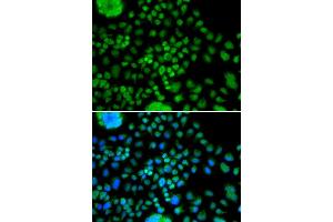 Immunofluorescence analysis of MCF-7 cells using ATOH7 antibody (ABIN5974375). (ATOH7 antibody)