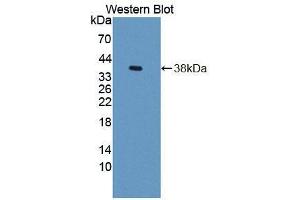 Western blot analysis of the recombinant protein. (GTF3A antibody  (AA 71-365))