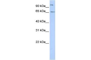 WB Suggested Anti-SPATA16 Antibody Titration: 0. (SPATA16 antibody  (N-Term))