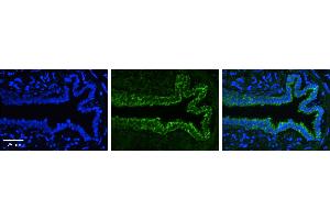 Immunohistochemistry (IHC) image for anti-Plasminogen Activator Inhibitor 1 (SERPINE1) (N-Term) antibody (ABIN2782976) (PAI1 antibody  (N-Term))
