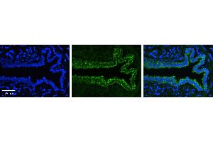 Immunohistochemistry (IHC) image for anti-Plasminogen Activator Inhibitor 1 (SERPINE1) (N-Term) antibody (ABIN310908) (PAI1 antibody  (N-Term))