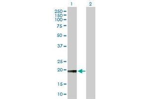 Western Blot analysis of NOP56 expression in transfected 293T cell line by NOP56 MaxPab polyclonal antibody. (NOP56 antibody  (AA 49-174))