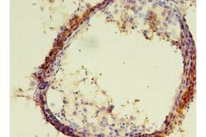 Immunohistochemistry of paraffin-embedded human testis tissue using ABIN7151992 at dilution of 1:100 (ERLIN1 antibody  (AA 27-346))