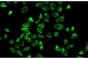 Immunofluorescence analysis of A-549 cells using HSD3B2 Polyclonal Antibody (HSD3B2 antibody)