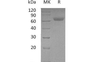 Western Blotting (WB) image for Angiopoietin-Like 4 (ANGPTL4) protein (Fc Tag) (ABIN7320470) (ANGPTL4 Protein (Fc Tag))