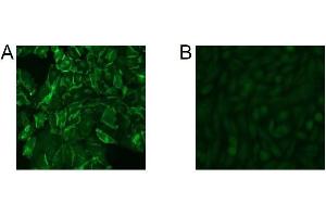 Immunofluorescence Microscopy of CHO cells using D14HD11. (CD66acde antibody)