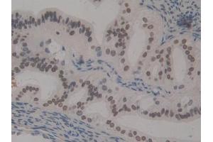 Detection of HMGN1 in Mouse Ovary Tissue using Polyclonal Antibody to High Mobility Group Nucleosome Binding Domain Protein 1 (HMGN1) (HMGN1 antibody  (AA 1-96))
