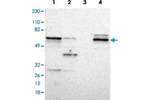 Western blot analysis of Lane 1: RT-4, Lane 2: U-251MG sp, Lane 3: Human plasma (IgG/HSA depleted), Lane 4: Human with DPYSL2 polyclonal antibody  at 1:250-1:500 dilution.