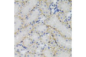 Immunohistochemistry of paraffin-embedded mouse kidney using SLC1A4 antibody (ABIN5971578) (40x lens). (SLC1A4 antibody)