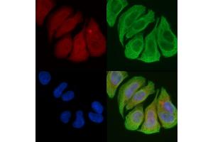 ABIN6258488 and ABIN6274479 staining Hela cells(45 min of heat-shock) by IF/ICC.