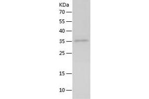 Western Blotting (WB) image for Interleukin 21 (IL21) (AA 18-146) protein (His-IF2DI Tag) (ABIN7284167) (IL-21 Protein (AA 18-146) (His-IF2DI Tag))