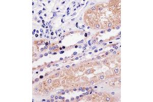 Immunohistochemical analysis of paraffin-embedded H. (PPP2R2A antibody  (N-Term))