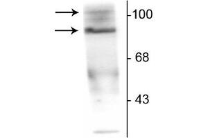 Western blot of T47D cell lysate prepared from cells that had been incubated in the presence of the synthetic progestin agonist R5020 (500 nM) showing specific immunolabeling of the ~90 kDa PR-A isoform and the ~120 kDa PR-B isoform of the progesterone receptor phosphorylated at Ser190. (Progesterone Receptor antibody  (pSer190))