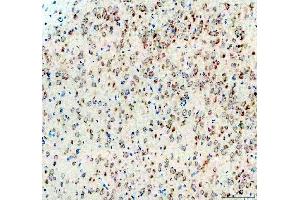 anti-Calcitonin-Related Polypeptide alpha (CALCA) (AA 83-119), (C-Term) antibody