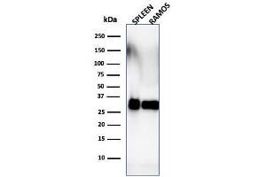 Western Blot Analysis of Ramos cells and human spleen tissue lysate using HLA-DRB Monoclonal Antibody (SPM288). (HLA-DRB1 antibody)