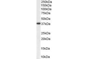 Western Blotting (WB) image for anti-Aldo-Keto Reductase Family 1, Member B1 (Aldose Reductase) (AKR1B1) antibody (ABIN5912019) (AKR1B1 antibody)