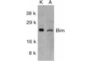 Image no. 2 for anti-BCL2-Like 11 (Apoptosis Facilitator) (BCL2L11) (Internal Region) antibody (ABIN201915) (BIM antibody  (Internal Region))