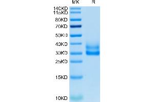 Cynomolgus/Rhesus macaque 4-1BB on Tris-Bis PAGE under reduced condition. (CD137 Protein (AA 24-186) (His tag))