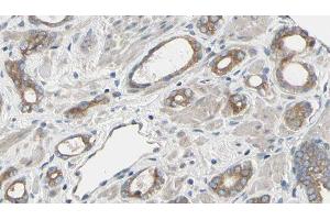 ABIN6277492 at 1/100 staining Human prostate tissue by IHC-P. (RRM2 antibody  (C-Term))