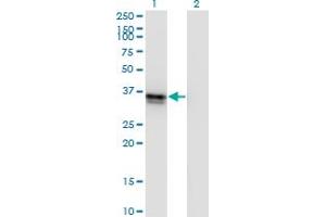 Western Blot analysis of FRZB expression in transfected 293T cell line by FRZB monoclonal antibody (M01), clone 4F7.