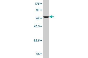 Western Blot detection against Immunogen (65. (PCBP2 antibody  (AA 1-362))