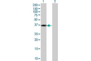 Western Blot analysis of DFNA5 expression in transfected 293T cell line ( H00001687-T01 ) by DFNA5 MaxPab polyclonal antibody. (DFNA5 antibody  (AA 1-295))