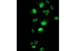Immunofluorescence (IF) image for anti-Tumor Protein P53 (TP53) antibody (ABIN1499973) (p53 antibody)
