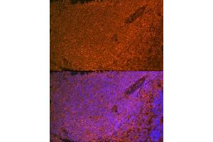 Immunofluorescence analysis of rat spleen using SHIP11 Rabbit mAb (ABIN7267882) at dilution of 1:100 (40x lens).