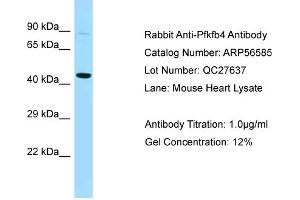 Western Blotting (WB) image for anti-6-phosphofructo-2-Kinase/fructose-2,6-Biphosphatase 4 (PFKFB4) (Middle Region) antibody (ABIN2786783) (PFKFB4 antibody  (Middle Region))