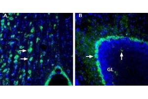 Expression of DP2 receptor (CRTH2/GPR44) in rat medial septum and mouse cerebellum - Immunohistochemical staining of perfusion-fixed frozen rat and mouse brain sections with Anti-CRTH2/GPR44 (extracellular) Antibody (ABIN7043564, ABIN7045118 and ABIN7045119), (1:200), followed by goat-anti-rabbit-AlexaFluor-488. (Prostaglandin D2 Receptor 2 (PTGDR2) (3rd Extracellular Loop), (AA 270-283) antibody)
