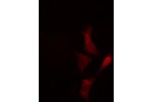 ABIN6274335 staining Hela cells by IF/ICC. (MTA1 antibody  (Internal Region))
