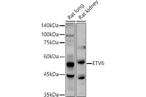 Western blot analysis of extracts of various cell lines, using ETV6 antibody (ABIN3022302, ABIN3022303, ABIN3022304, ABIN1512878 and ABIN6218719) at 1:1000 dilution. (ETV6 antibody  (AA 1-300))