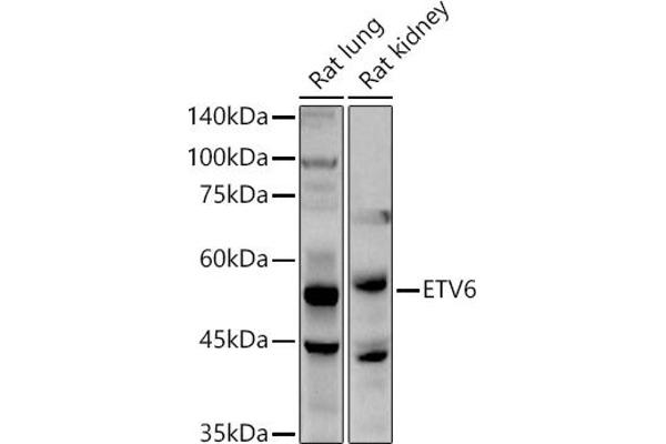 ETV6 anticorps  (AA 1-300)