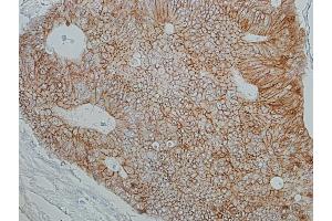 Immunohistochemistry (IHC) image for anti-Catenin, beta (CATNB) (AA 725-775) antibody (ABIN7455205)