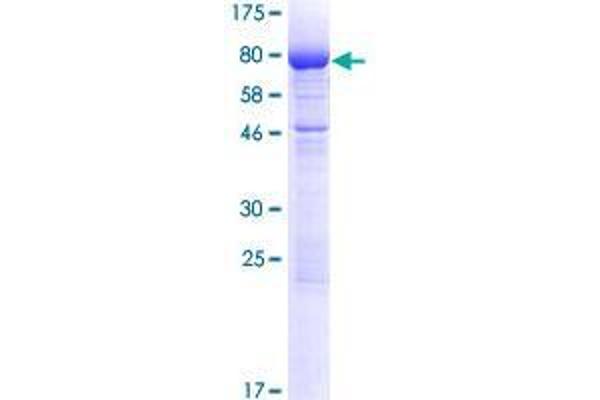 GPKOW Protein (AA 1-476) (GST tag)