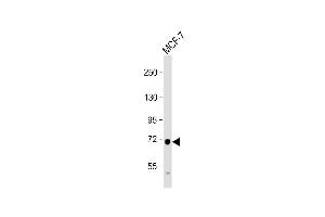 Western Blot at 1:1000 dilution + MCF-7 whole cell lysate Lysates/proteins at 20 ug per lane.
