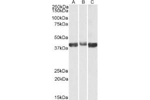 ABIN2613377 (0. (ALDOA antibody  (AA 86-96))