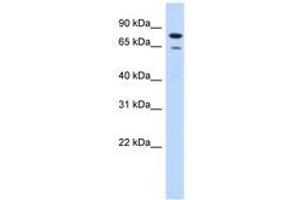 Image no. 1 for anti-Homolog of Yeast RecQ-mediated Genome Instability 1 (RMI1) (AA 71-120) antibody (ABIN6740966) (RMI1 antibody  (AA 71-120))