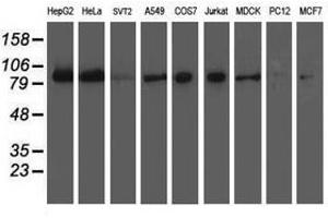 Image no. 2 for anti-Excision Repair Cross-Complementing Rodent Repair Deficiency, Complementation Group 4 (ERCC4) antibody (ABIN1498071) (ERCC4 antibody)