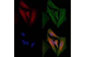 ABIN6264983 and ABIN6266656 staining  cells by IF/ICC.