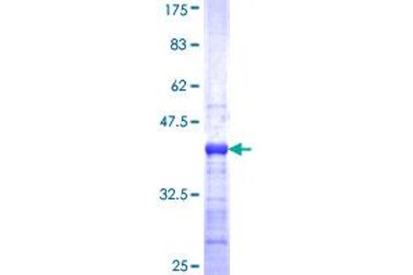 MUC7 Protein (AA 36-135) (GST tag)