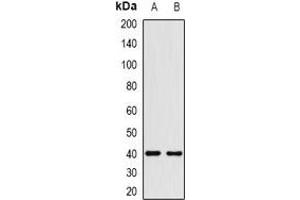 Western blot analysis of HMG-20A expression in HEK293T (A), Hela (B) whole cell lysates. (HMG20A antibody)